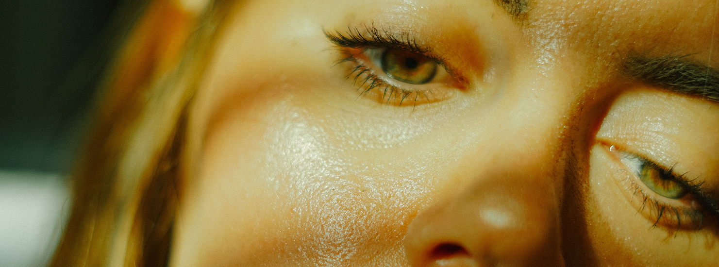 oily-skin